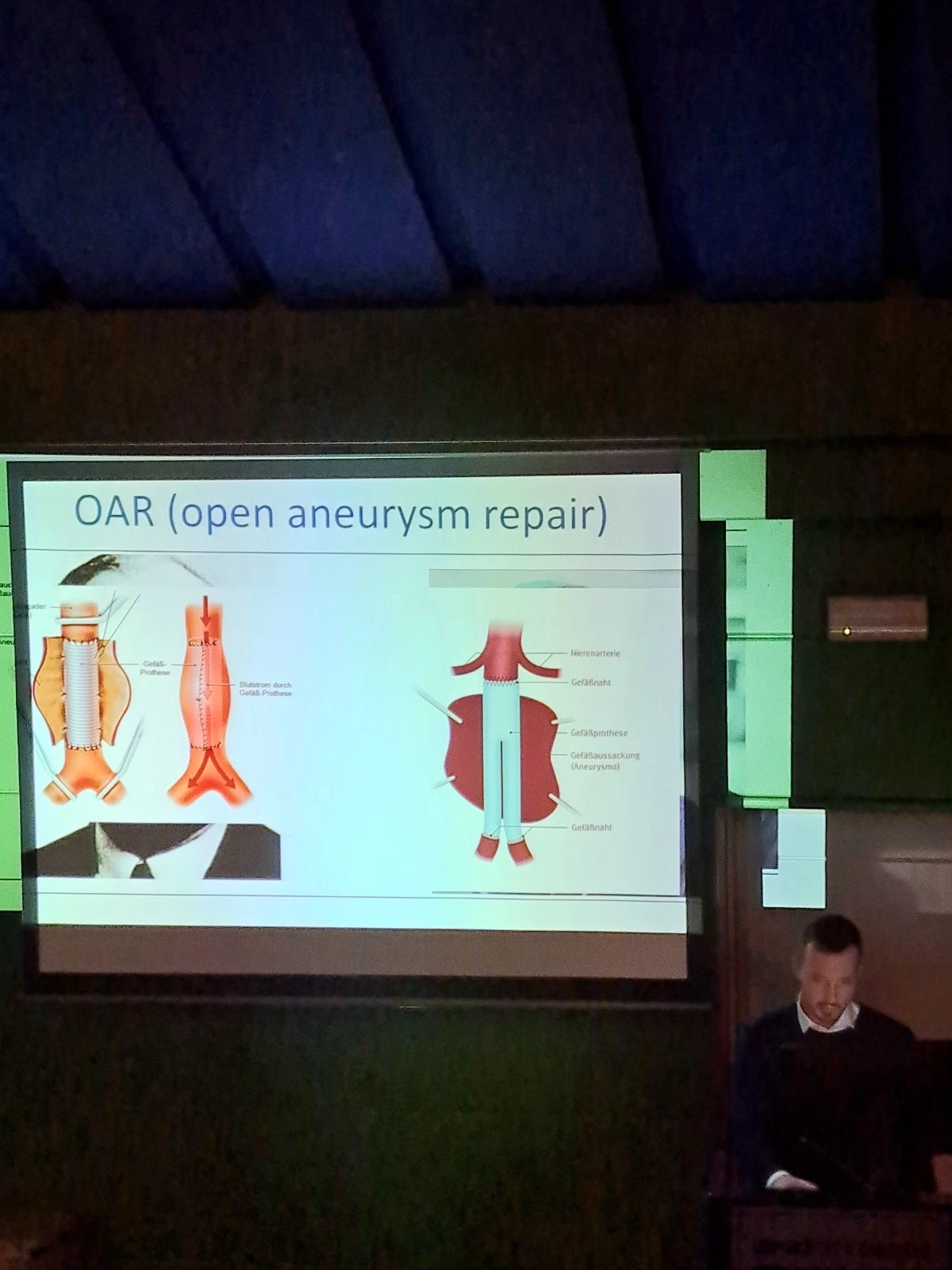 Dr. Amir Arnautović endovaskularni hirurg iz Njemačke na prenosu znanja na KCUS